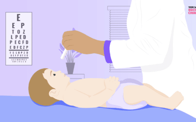 Homocistinuria: conozca más sobre esta enfermedad rara genética